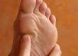 Could the Sore on My Foot be a Fungal Infection?