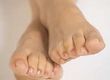 How Can I Relieve Stubborn Foot Odour?