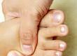 Nerve Damage to Feet or Diabetic Neuropathy